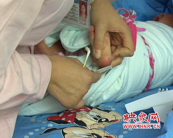 醫(yī)護(hù)人員在為一名新出生嬰兒采足跟血，做疾病篩查