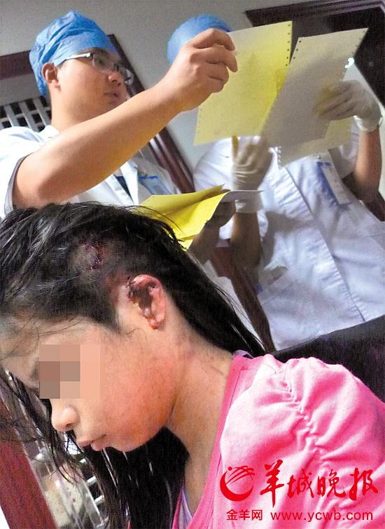 受傷的11歲女孩頭發(fā)被卷入扶梯，耳朵被嚴(yán)重拉傷，需手術(shù)。