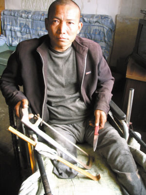 鄭艷良就是用這幾樣簡陋工具，給自己做了右腿截肢手術(shù)。