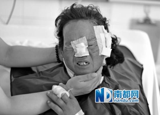 受狼群襲擊受傷較重的村民在接受救治。C FP圖片