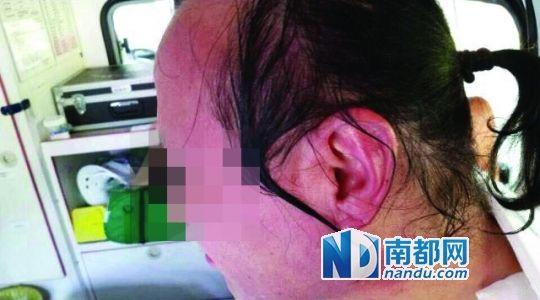 涉事教師遭熱水潑臉后的照片。