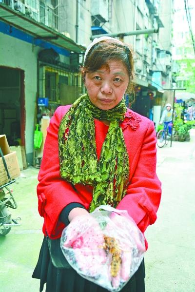 頭部受傷的黃女士展示兩根大魚刺。