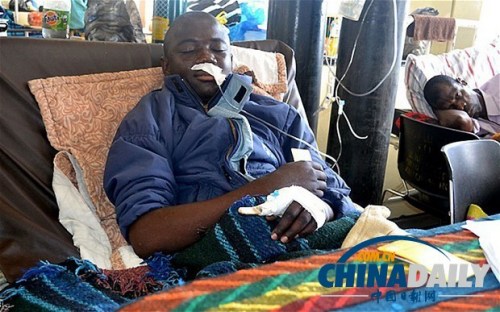 雖然已經(jīng)在醫(yī)院接受了近一個(gè)月的恢復(fù)治療，卡托卡的身體仍然非常虛弱。