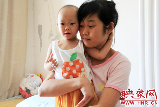 孩子和媽媽在一起，她的右眼已經(jīng)失明。