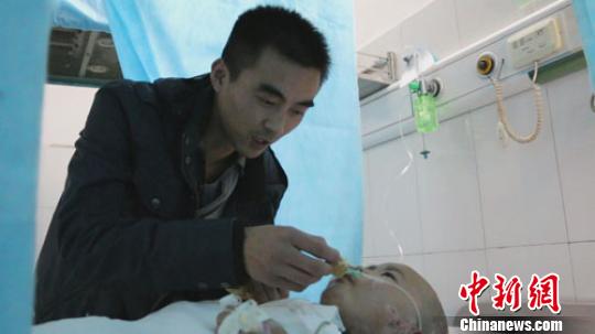 河南掉油鍋重傷女童4次植皮已轉(zhuǎn)出重癥監(jiān)護室 河南掉油鍋重傷女童4次植皮已轉(zhuǎn)出重癥監(jiān)護室