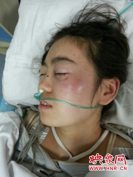 9月10日晚,被暴打的小陳出現(xiàn)了間歇性昏迷,被送進(jìn)了省人民醫(yī)院。