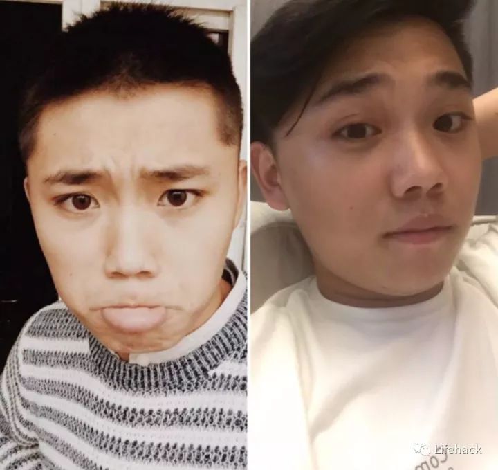 長胖20斤，臉型怎么變？這些例子看完扎心了！