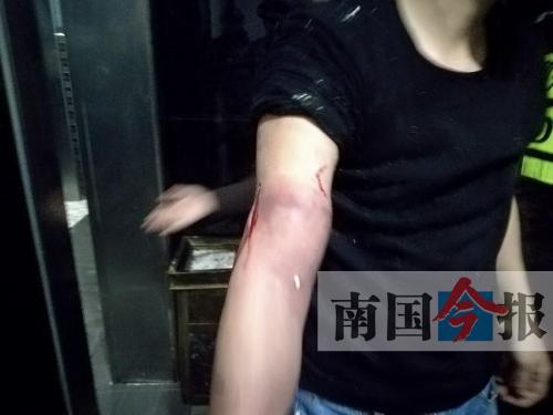 覃先生手臂被卡的部位受傷流血，所幸傷勢(shì)無(wú)大礙。 通訊員 王建民 攝
