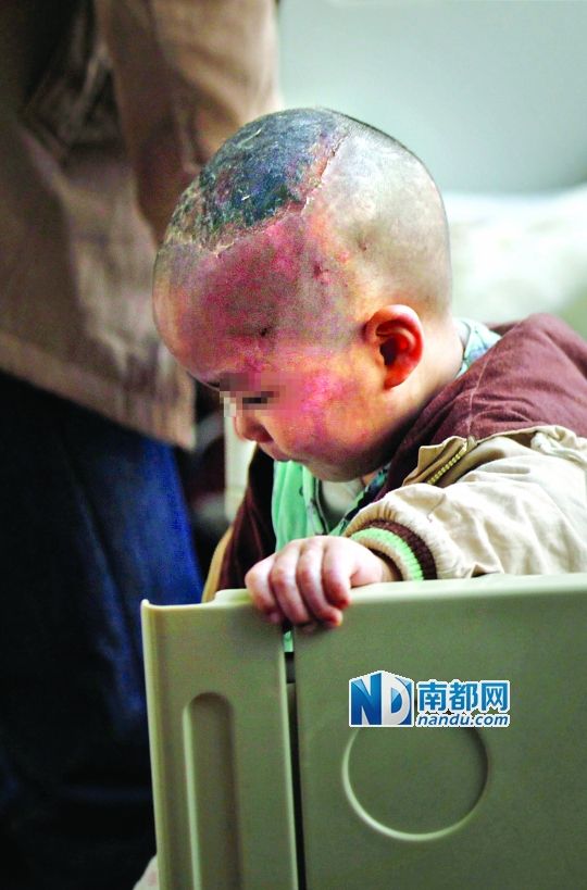 1月8日下午，小寶頭上和臉上都是傷痕。