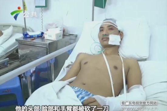 另一名傷者頭部、臉部和手臂都被砍了一刀。(視頻截圖)