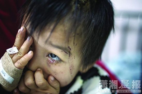 1月13日，湖南省兒童醫(yī)院，4歲的源源用手蒙住了眼睛。
