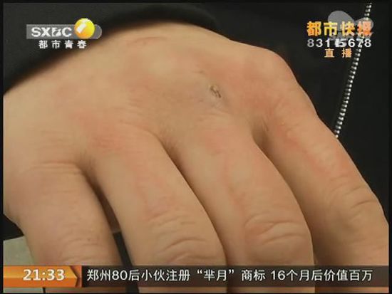 說(shuō)到這足療拔罐，估計(jì)大伙都不陌生，但是想起4號(hào)晚上的拔罐的經(jīng)歷，呂先生現(xiàn)在想起來(lái)，還心有余悸。