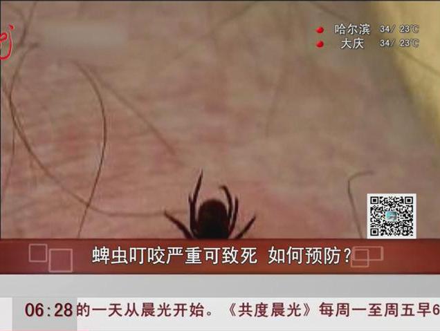 蜱蟲叮咬嚴(yán)重可致死如何預(yù)防？