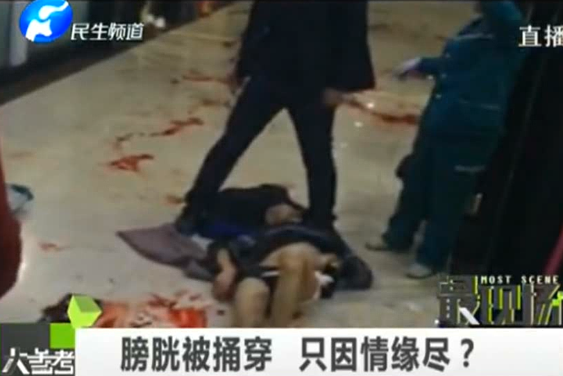膀胱被捅穿 只因情緣盡？